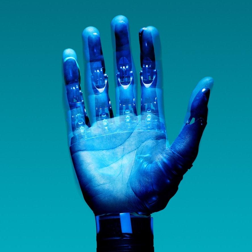 Image of a prosthetic arm